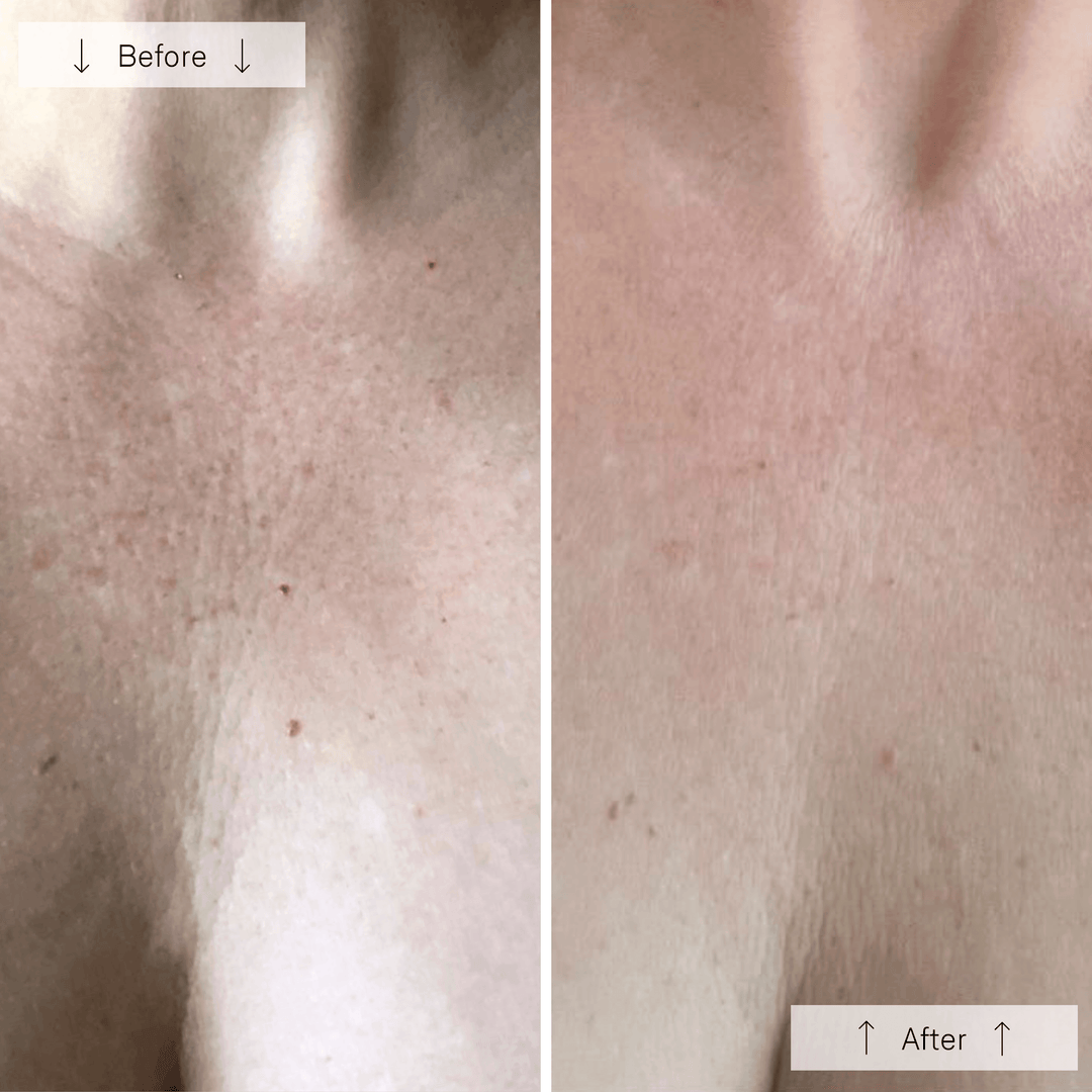 Omnilux Contour Neck & Décolleté Mask